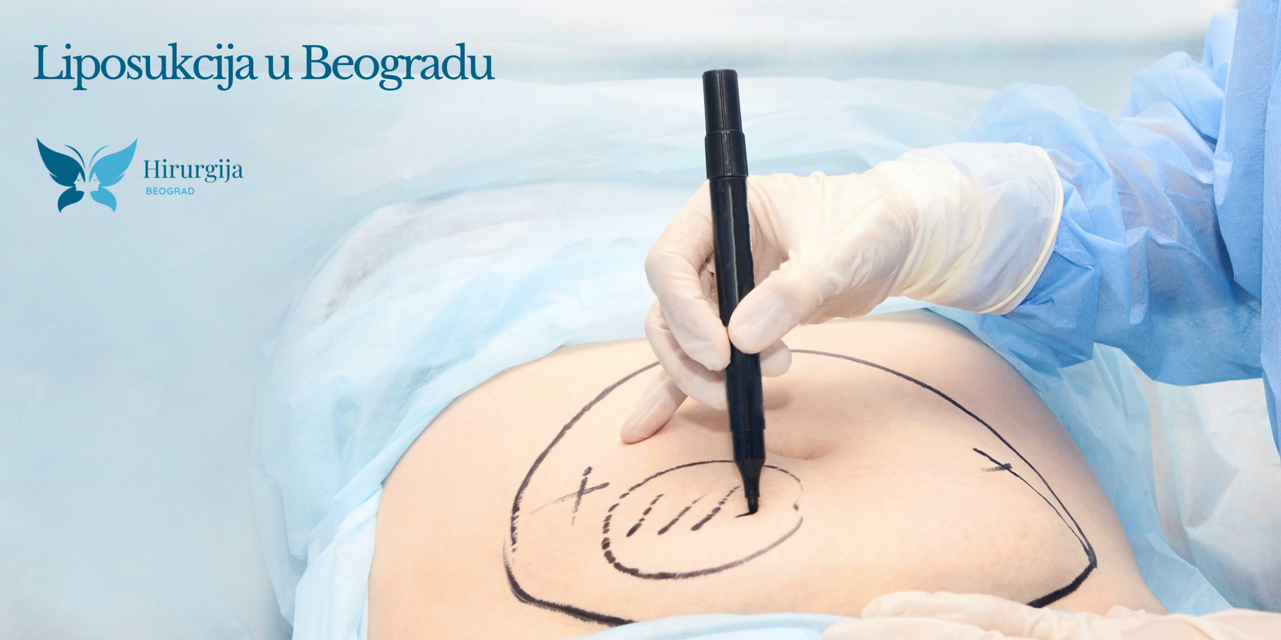 Liposukcija u Beogradu: Sve što treba da znate pre nego što se odlučite za ovaj zahvat