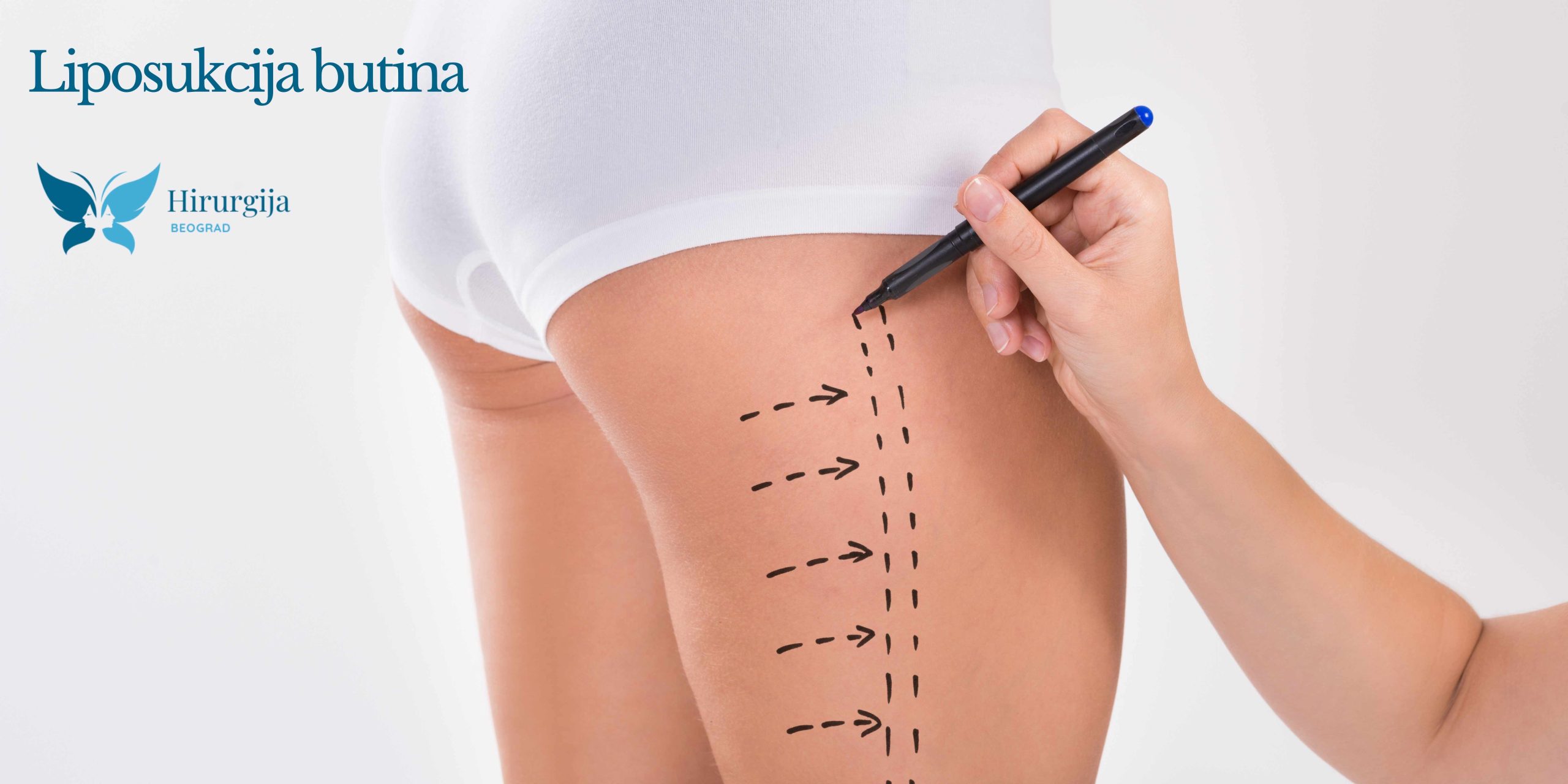Liposukcija butina: put ka vitkim nogama u Beogradu