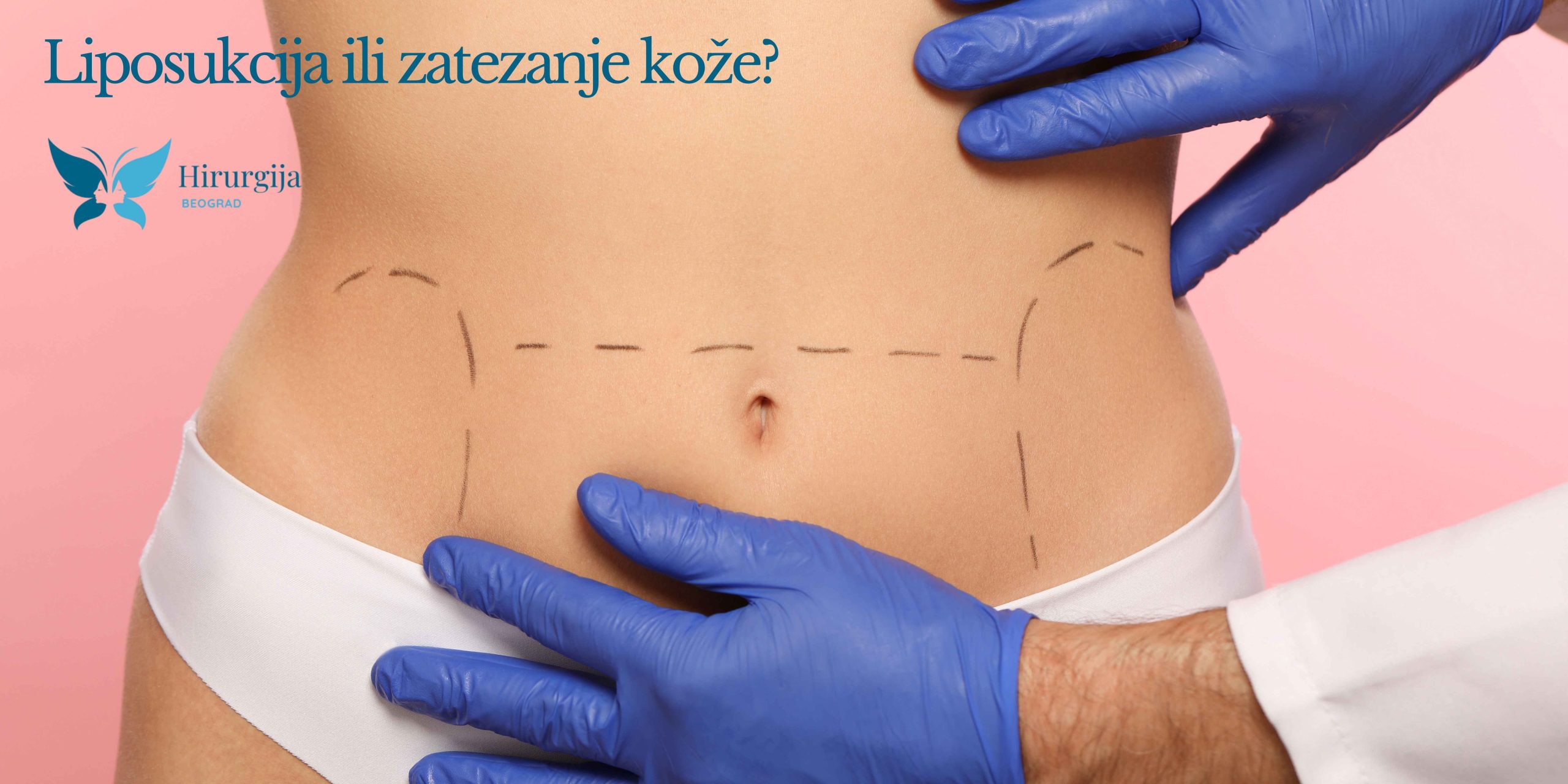 Liposukcija ili zatezanje kože: koji tretman je pravi za vas?