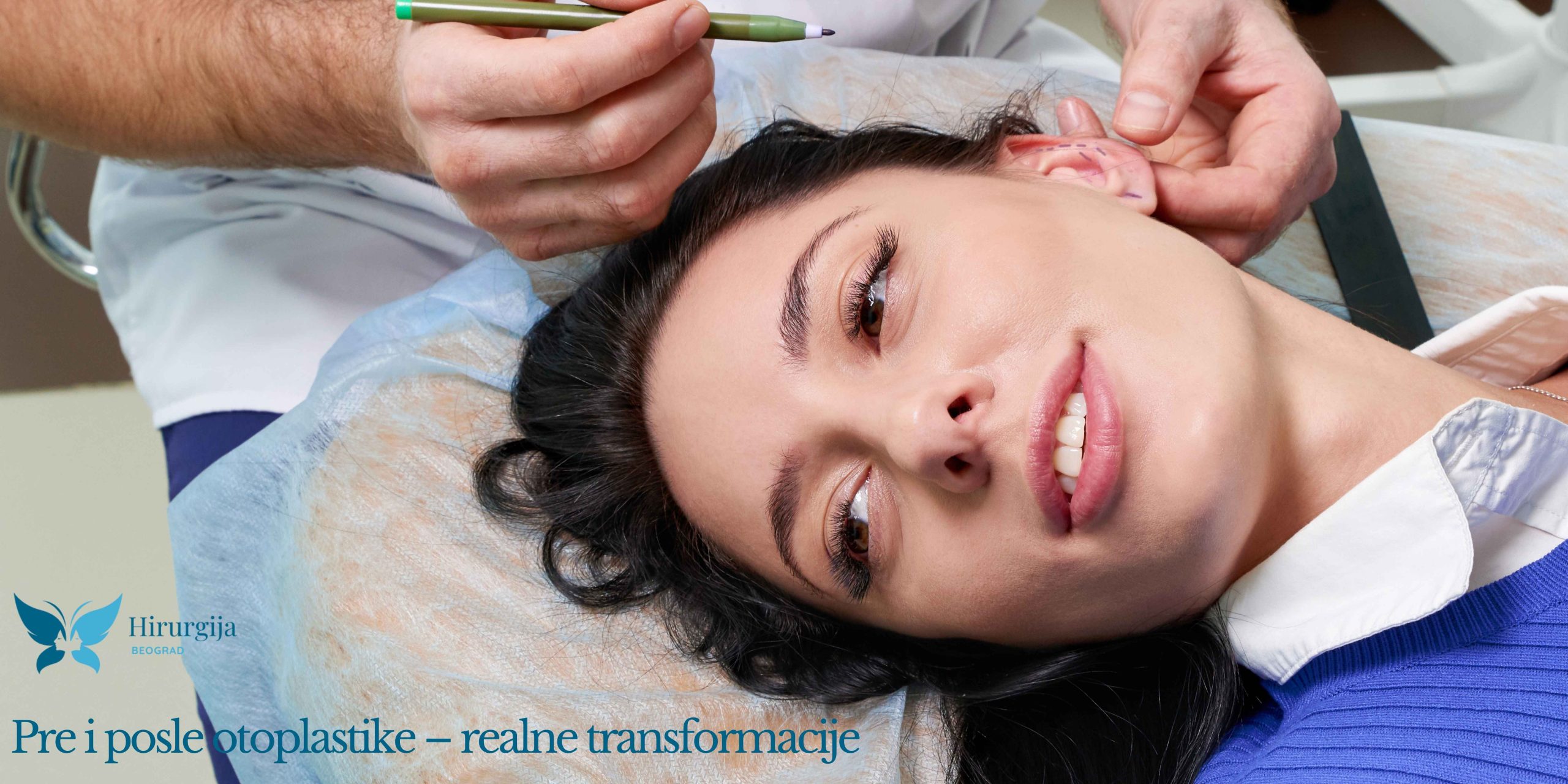 Pre i posle otoplastike – realne transformacije